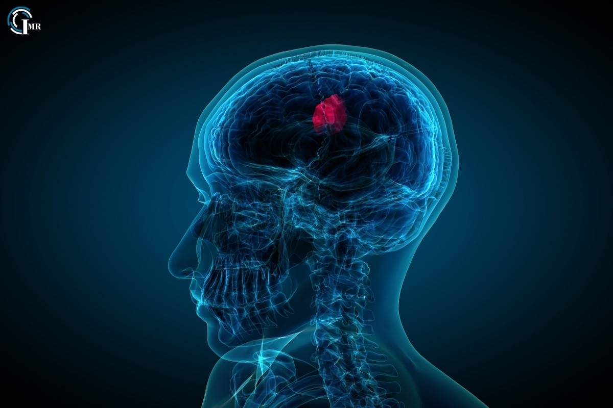 Blood-Brain Barrier: Exploring its Structure, Function, Significance in Neurological Health | Insider Market Research