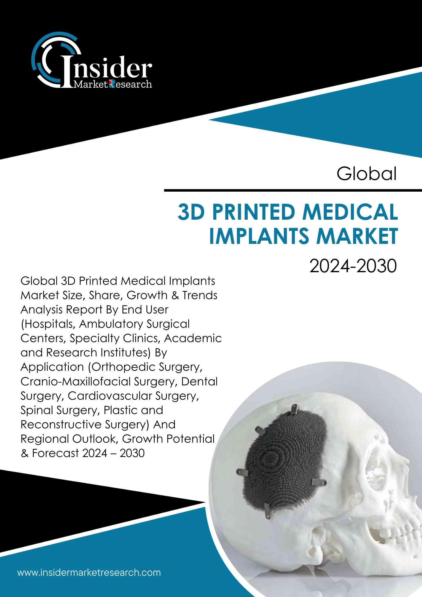 3D Printed Medical Implants Market Size, Share, Growth and Forecast to 2030 | Insider Market Research