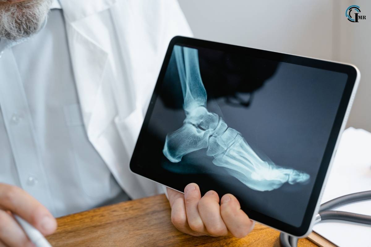 Digital Radiography: Benefits, Applications, Challenges and Future | Insider Market Research